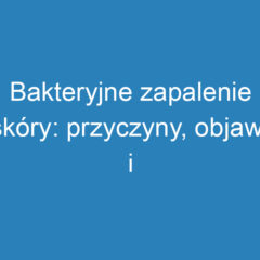 Bakteryjne zapalenie skóry: przyczyny, objawy i leczenie