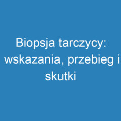 Biopsja tarczycy: wskazania, przebieg i skutki uboczne