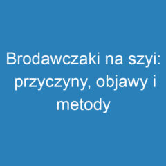 Brodawczaki na szyi: przyczyny, objawy i metody usuwania