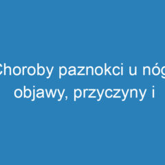 Choroby paznokci u nóg: objawy, przyczyny i skuteczne leczenie