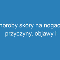 Choroby skóry na nogach: przyczyny, objawy i leczenie