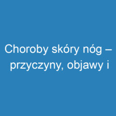 Choroby skóry nóg – przyczyny, objawy i skuteczne leczenie