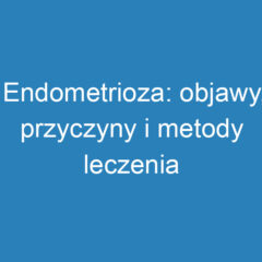 Endometrioza: objawy, przyczyny i metody leczenia tej choroby