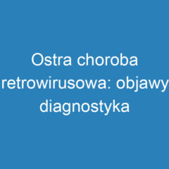 Ostra choroba retrowirusowa: objawy, diagnostyka i leczenie HIV