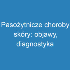 Pasożytnicze choroby skóry: objawy, diagnostyka i profilaktyka