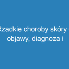 Rzadkie choroby skóry – objawy, diagnoza i opcje leczenia