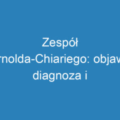 Zespół Arnolda-Chiariego: objawy, diagnoza i metody leczenia