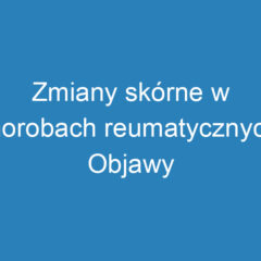 Zmiany skórne w chorobach reumatycznych: Objawy i leczenie